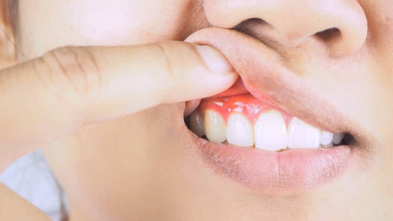 5 أمراض خطيرة يمكن اكتشافها عن طريق الفم