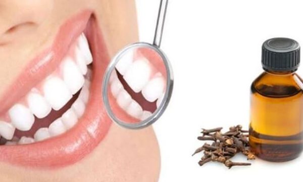 أهم 4 فوائد القرنفل للأسنان تعرف عليها