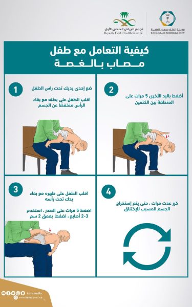 سعود الطبية: 4 خطوات للتعامل مع طفل مصاب بالغصة.. تعرفوا عليها