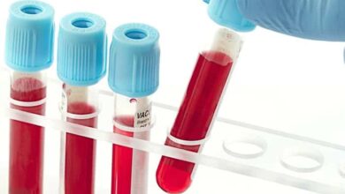 ما معنى PCT في تحليل الدم؟