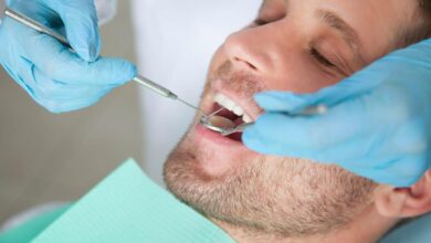 هل تنظيف الأسنان عند الطبيب يفطر الصائم؟