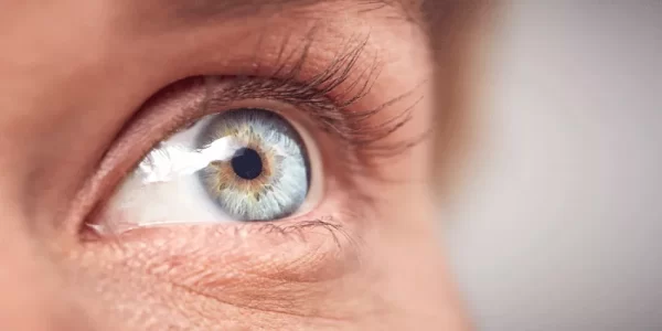 علامات سرطان العين الأكثر شيوعا وطرق العلاج